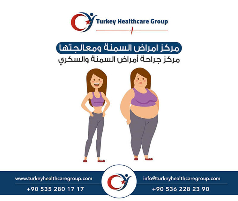امراض السمنة ومعالجتها - Turkey Healthcare Group