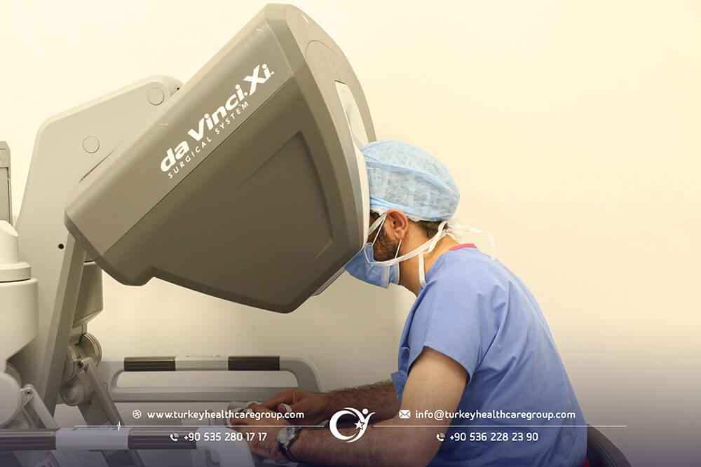 عملية استئصال البروستات بالجراحة الروبوت دافنشي مركز جراحة الروبوتية