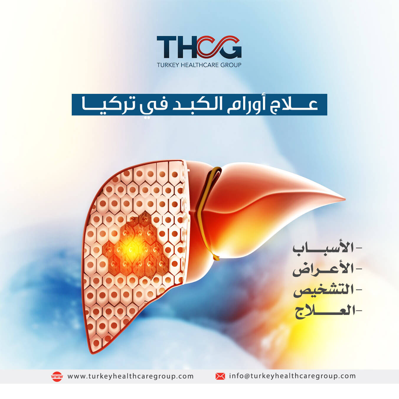 علاج أورام الكبد في تركيا - Turkey Healthcare Group