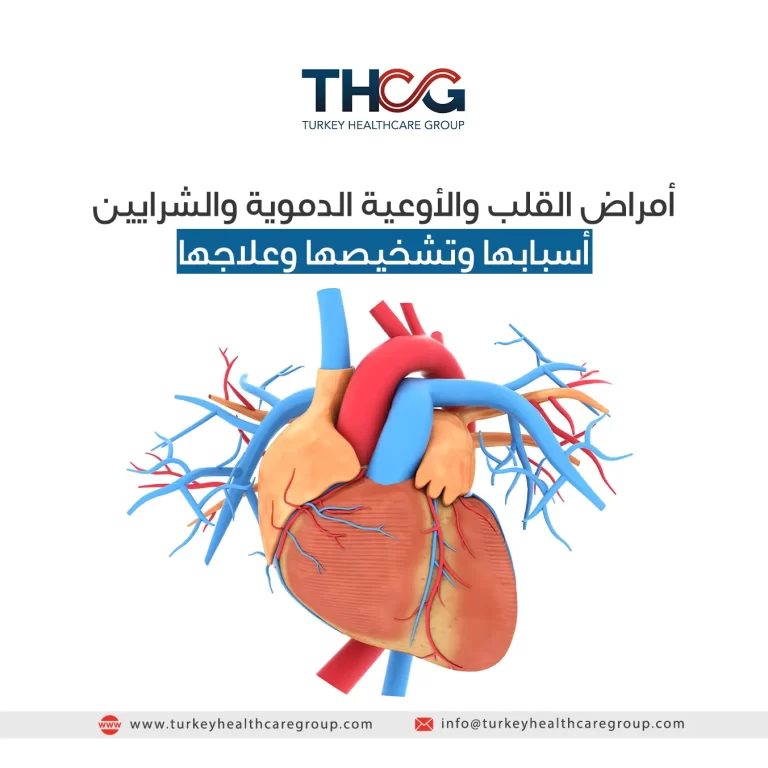أمراض القلب والأوعية الدموية والشرايين