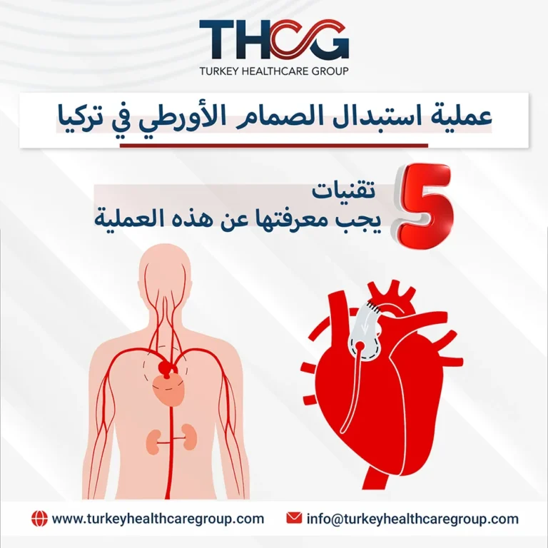 استبدال الصمام الأورطي في تركيا