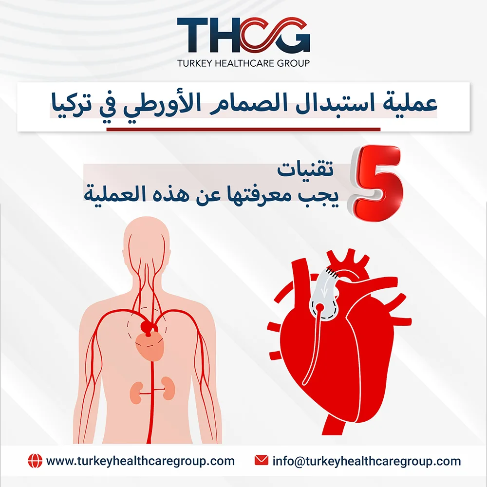 استبدال الصمام الأورطي في تركيا