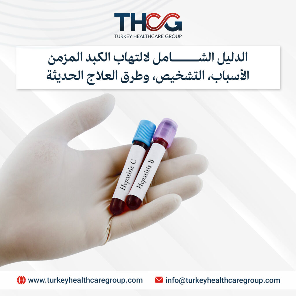 الدليل الشامل لالتهاب الكبد المزمن — الأسباب، التشخيص، وطرق العلاج الحديثة | 2026