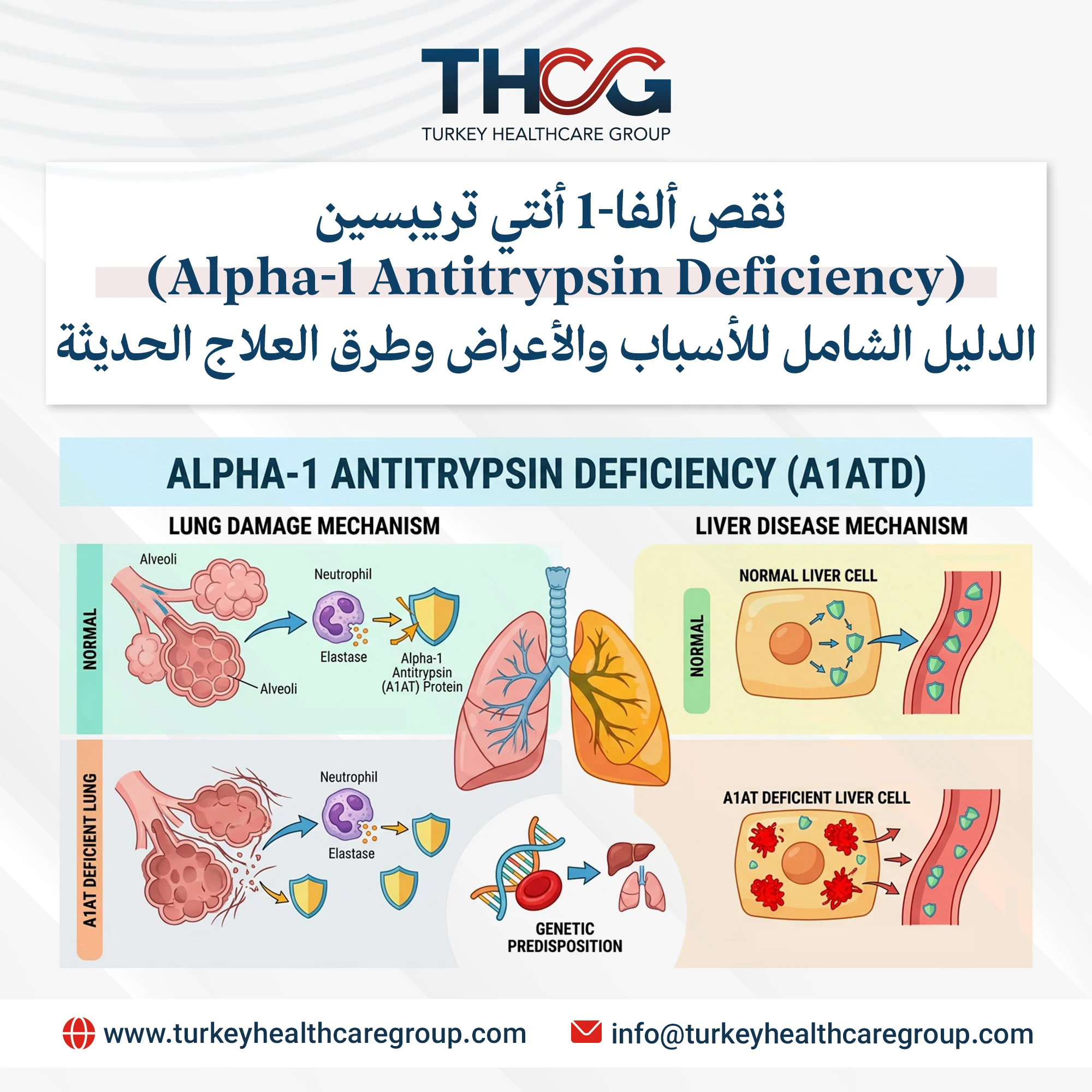 نقص ألفا-1 أنتي تريبسين: 6 حقائق تكشف المرض الوراثي الصامت الذي يدمر رئتيك وكبدك