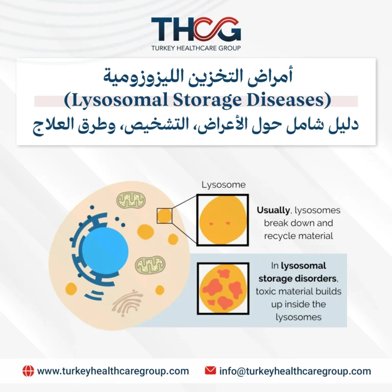 أمراض التخزين الليزوزومية (Lysosomal Storage Diseases)