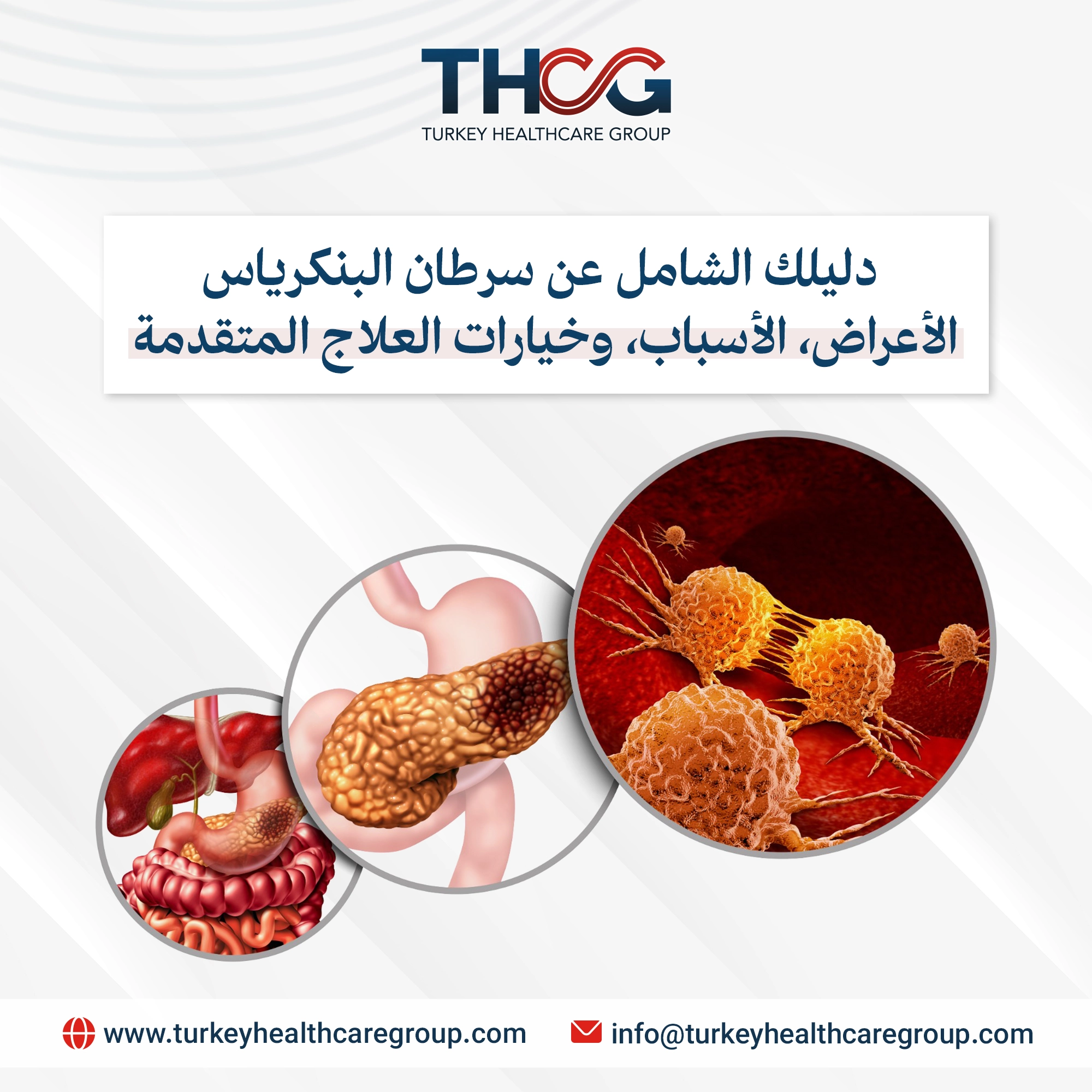 سرطان البنكرياس