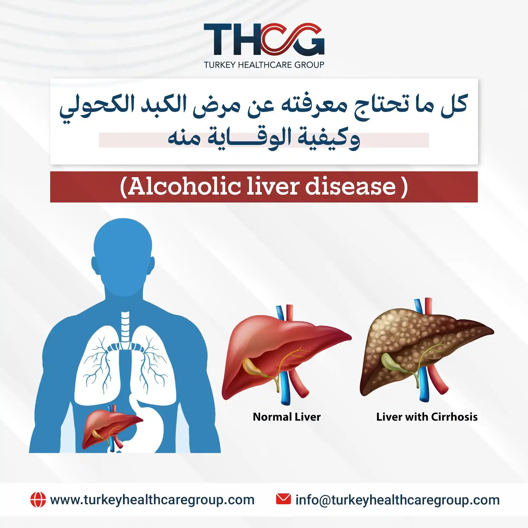 مرض الكبد الكحولي
